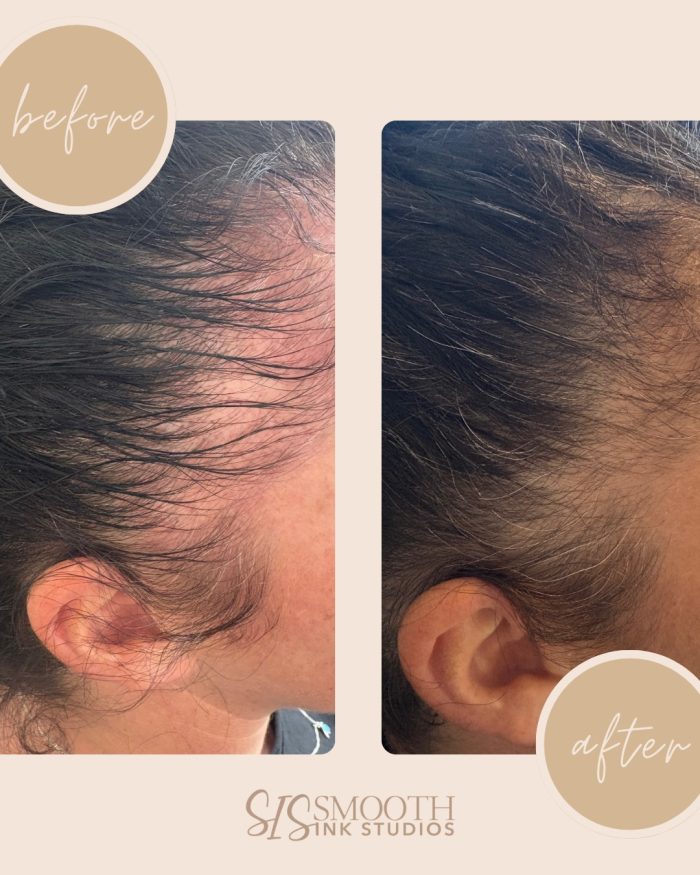 NUE STRAND Before and After