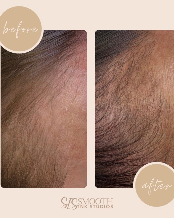 NUE STRAND Before and After