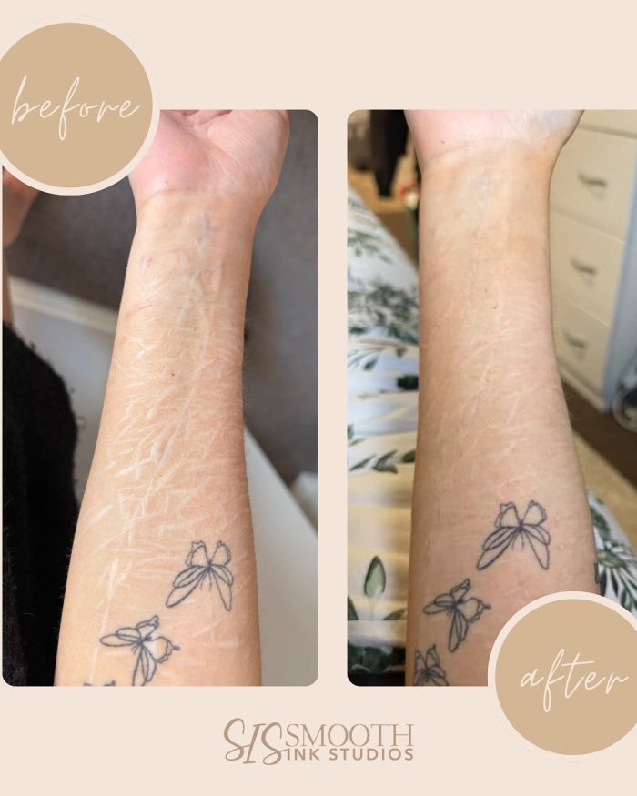 Neutral Before and After Neutral Before and After