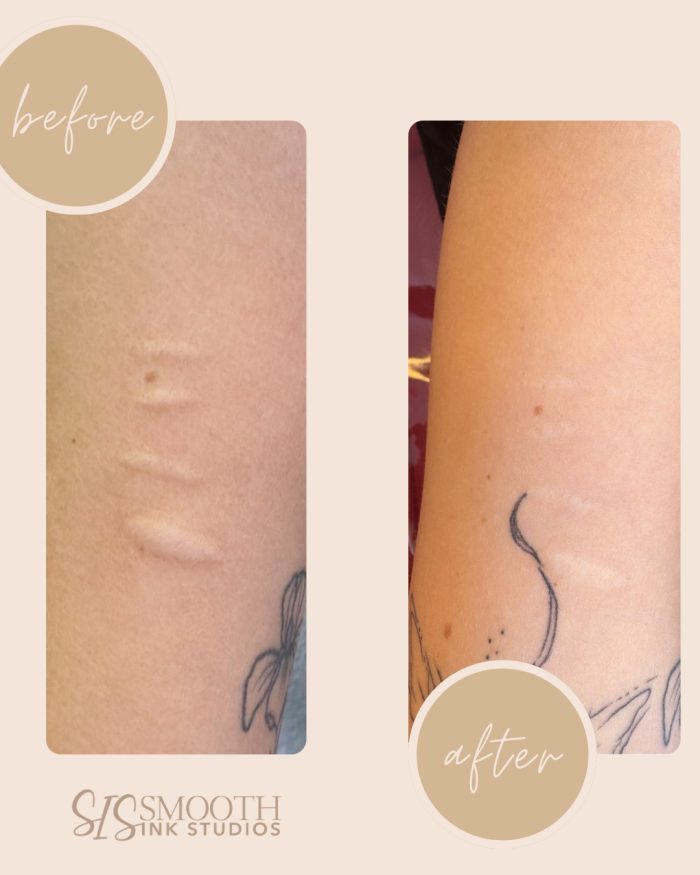 Neutral Before and After Neutral Before and After